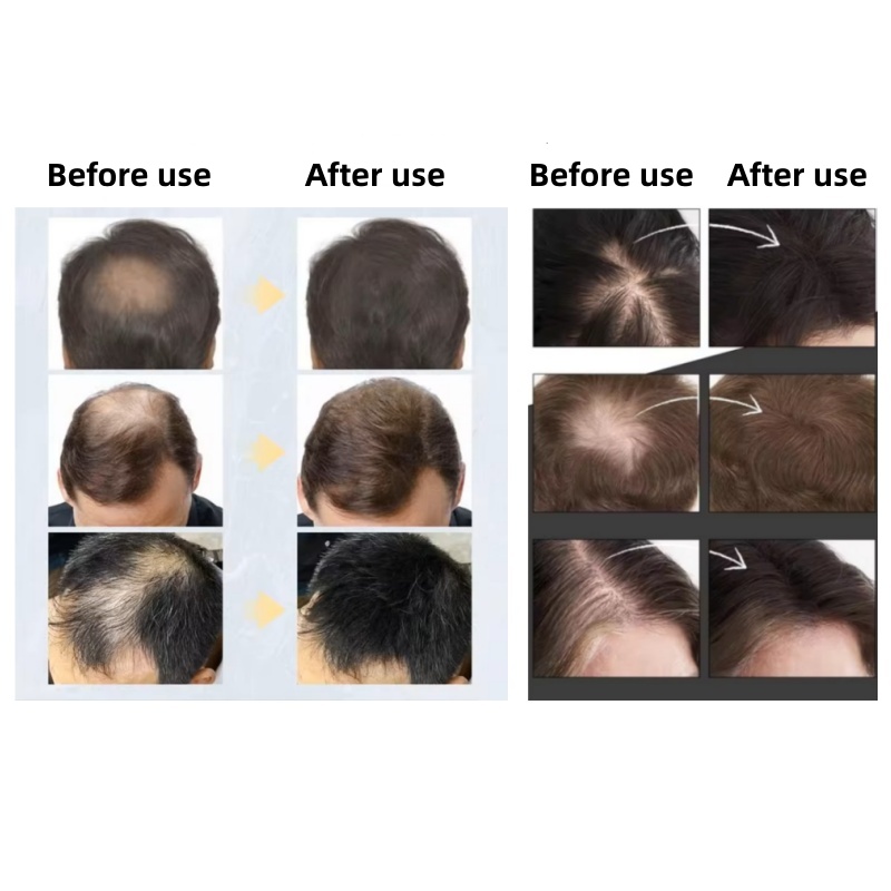 20pcsHair Fiber Keratin Hair B - огляд і ціна Hair Care Natural