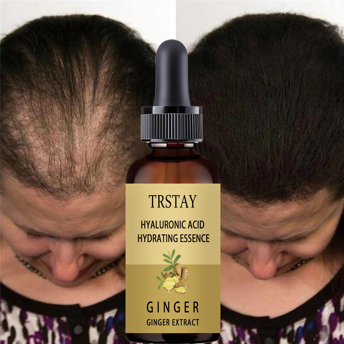 Hair Growth Serum Anti Prevent - огляд і ціна Caffeine Hair Serum