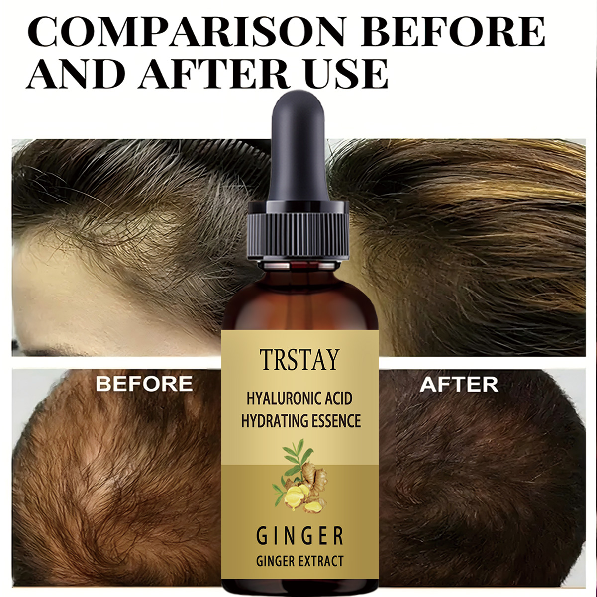 Hair Growth Serum Anti Prevent - огляд і ціна Caffeine Hair Serum