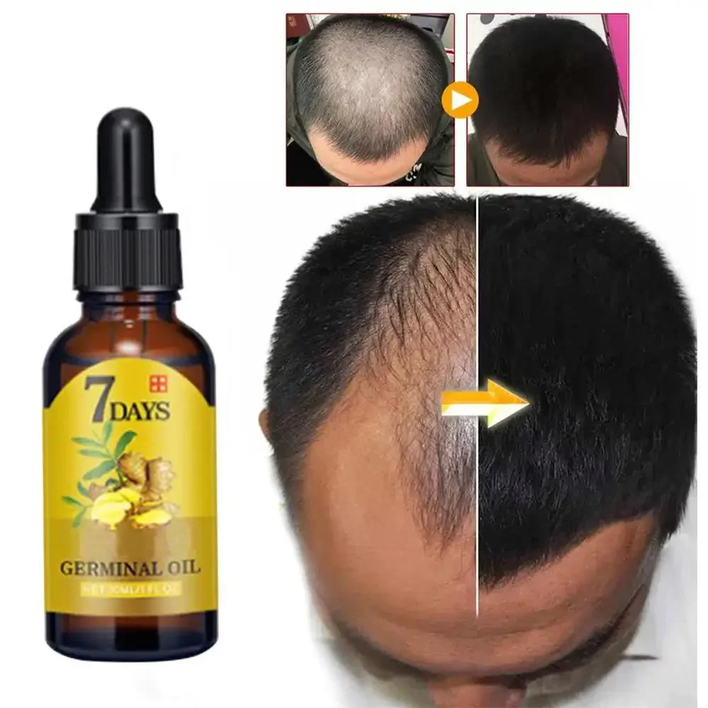 Hair Growth Ginger Fast Growin - огляд і ціна Caffeine Hair Serum