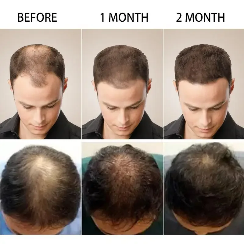 Hair Growth Ginger Fast Growin - огляд і ціна Caffeine Hair Serum